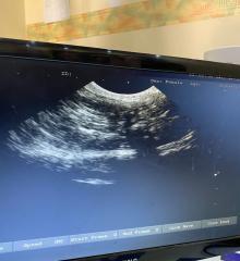 Ultrasound